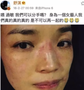 养猫人看着就流泪：对猫毛过敏怎么办？难道真的不养了？
